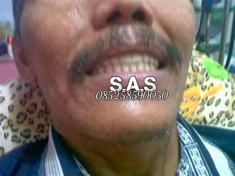 Check spelling or type a new query. S.A.S - AHLI GIGI KOTA PATI, Jateng & KOTA JEMBER, Jatim ...