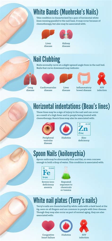 Deep horizontal ridges or depressions, known as beau's lines, are more alarming. What Your Fingernails Reveal - Miracles of Health