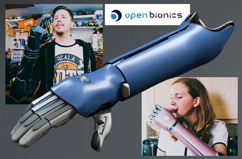 Open Bionics Introducing Hero Arm Closing The Gap