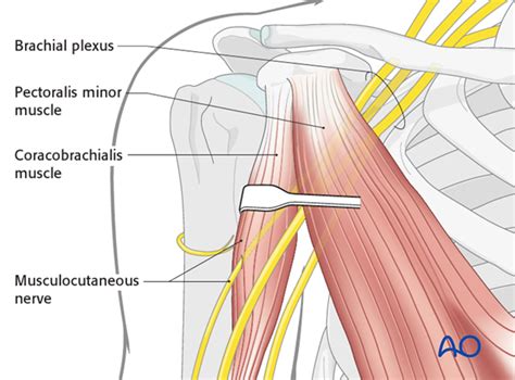 Related posts of shoulder muscles and tendons diagram muscle anatomy knee. Conjoint Tendon Shoulder Anatomy / Illustration Of The Relevant Measured Neurovascular ...