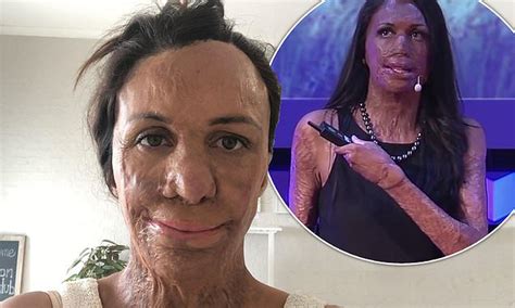 Inspirational Burns Survivor Turia Pitt Looks Back On Her Embarrassing Business Mistakes