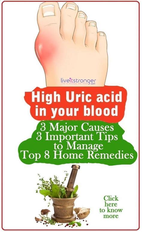 Natural Cures For Arthritis Hands How To Reduce High Uric Acid In
