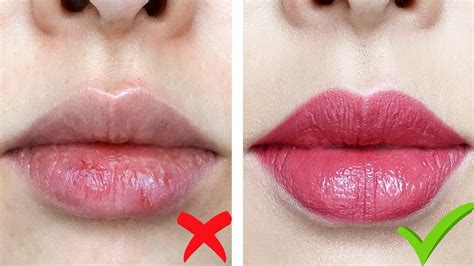 How Can I Fix My Chapped Lips Lipstutorial Org