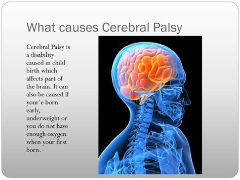 Ppt Cerebral Palsy Powerpoint Presentation Free Download Id2673628