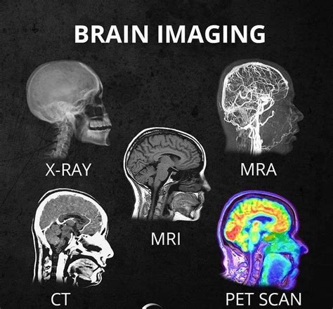 Cat scan vs mri the advancement in the field of medical science has made the imaging field of the body much easier with cat and mri scans. (3) What's the difference between all the different head ...