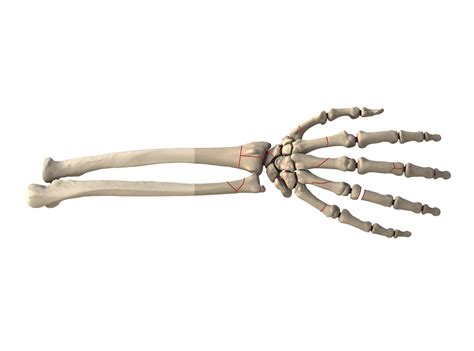 Hand And Wrist Single Bone Fractured Synbone