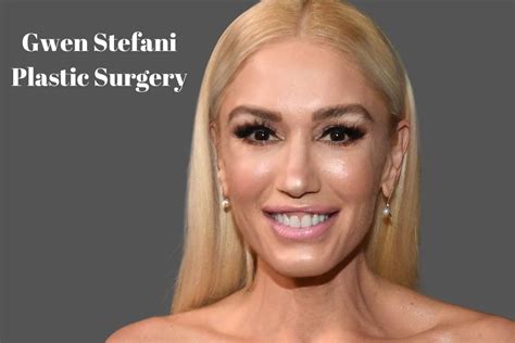 Gwen Stefani Plastic Surgery How She Got A ‘face Lift Lake County News