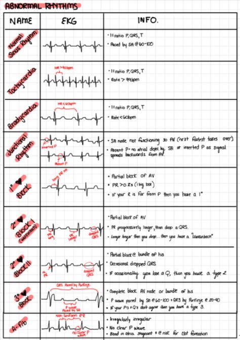 Pin By Tricia Headley Cunningham On Critical Care Nursing Cheat Sheets