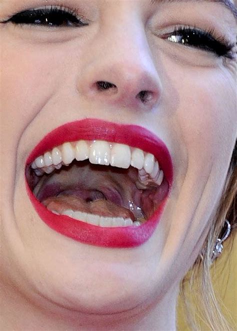 Anne Hathaway Beautiful Teeth Anne Hathaway Beauty