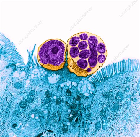 Cryptosporidium hominis, which primarily infects humans; Cryptosporidium (TEM) - Stock Image - C012/1434 - Science ...