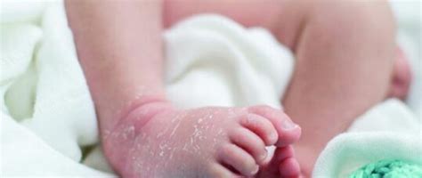 Treating Dry Skin Conditions In Children And Babies Nursing In Practice