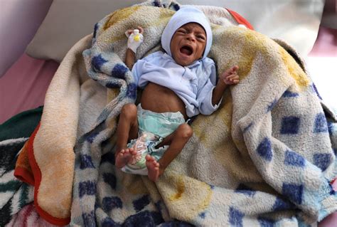 Rate of starving children in Yemen reaches new high, UN warns | The Independent