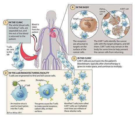 Car T Cell Therapy System Accegen