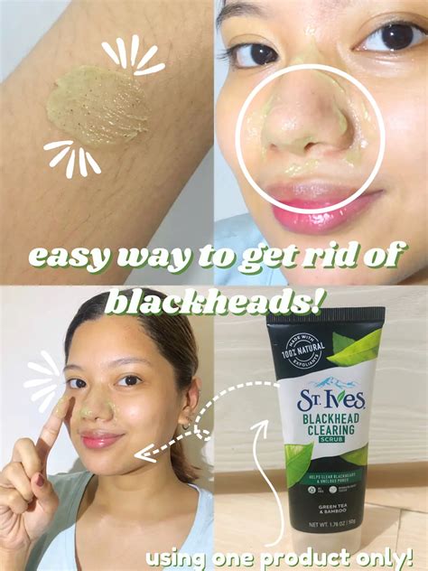 Easy Way To Get Rid Of Blackheads Gallery Posted By Bien Lemon8