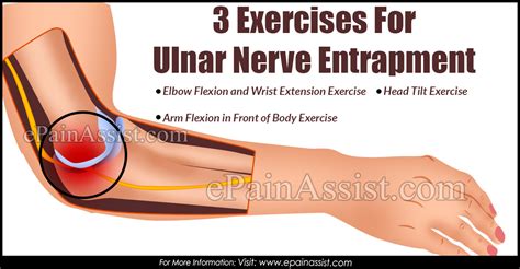 3 Exercises For Ulnar Nerve Entrapment