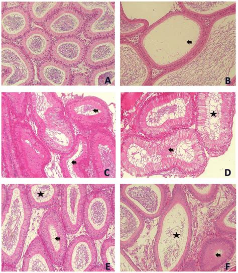 Photomicrographs Showing The Epididymis Tissues Of The Control And