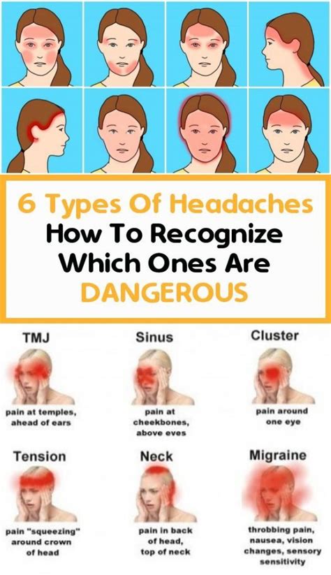 Headache On Left Temple And Eye Headache