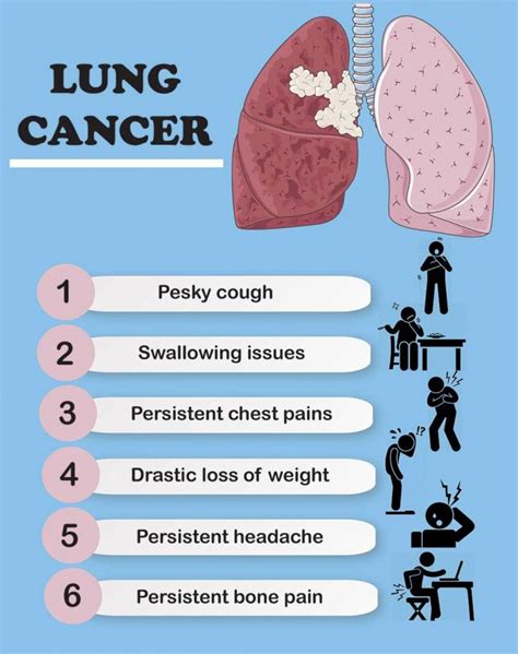Symptoms Of Lung Cancer Causes Signs And Risk Factors My Health Only