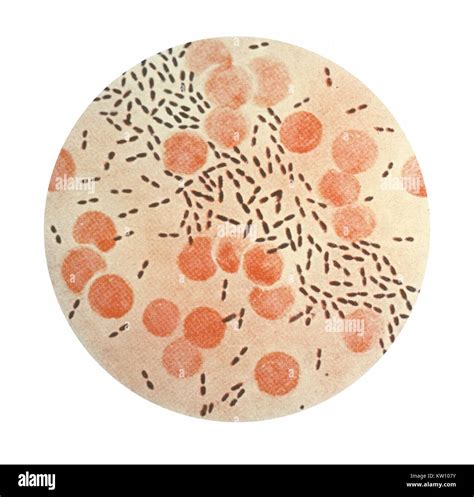 Esta Ilustración Muestra Una Vista Photomicrographic De Streptococcus