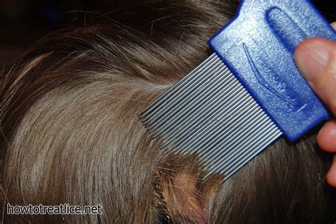 How To Treat Lice Cure Lice With Combs