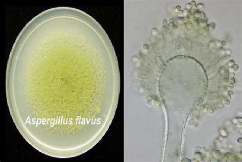 Flavus can contribute to the storage rots, especially when the plant material is stored at high moisture levels. Aspergillus flavus: características, morfologia, doenças ...