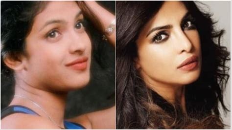 Priyanka Chopra Almost Lost Her First Film After A Nose Surgery Heres How Her Looks Have