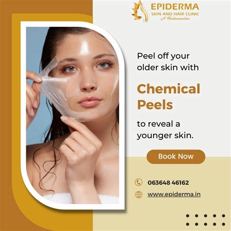 Ppt Chemical Peels Best Skin Clinic In Jayanagar Bangalore