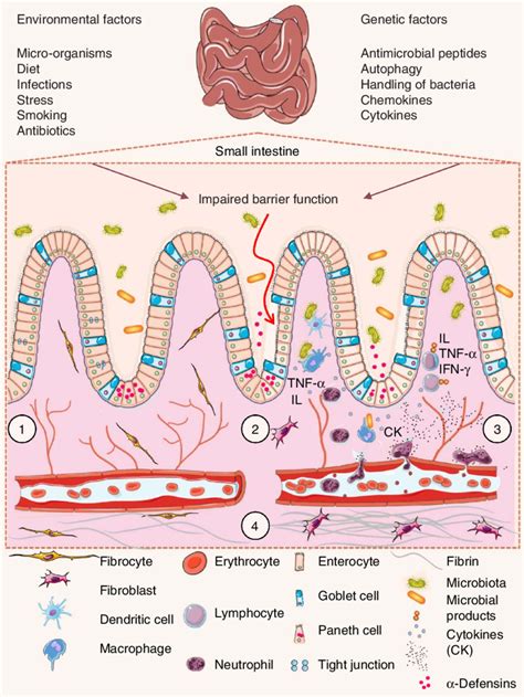 Pathophysiology Of Inflammatory Bowel Disease 1 The Villi And