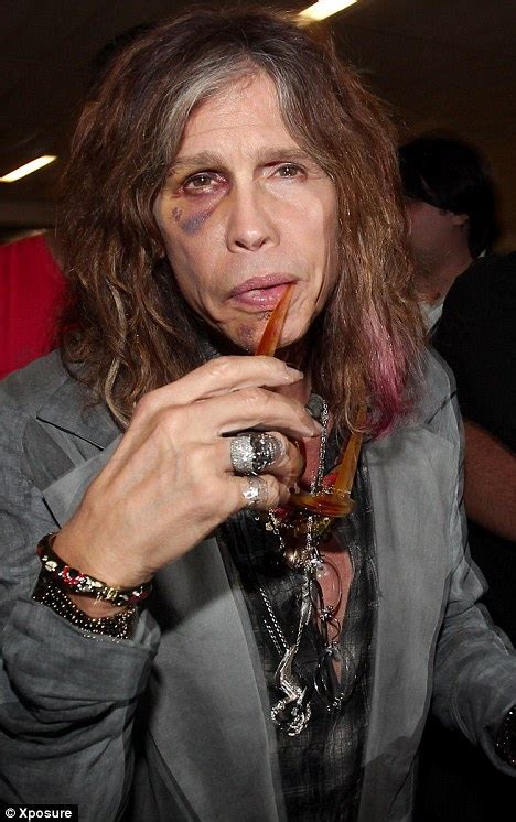 Aerosmith S Steve Tyler Shows Off Bruised And Battered Face From Shower