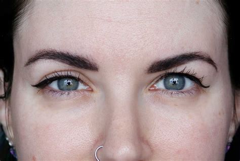 Hooded Eyelids Before And After Thebrokensealblog