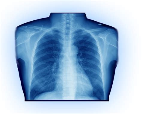 X Ray Png Png Image Collection