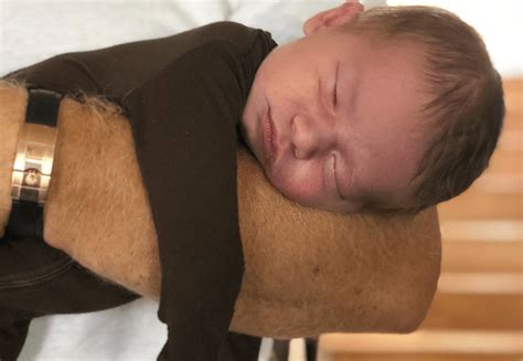 Crew Gaines Syndrome