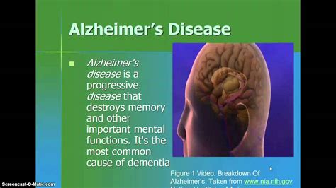 Alzheimers Disease Presentation Youtube