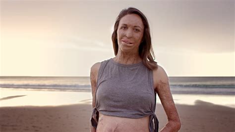 Turia Pitt Returns For Moving New Super Nature Campaign B T