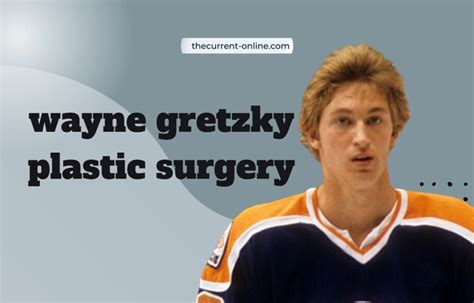 Wayne Gretzky Before And After Plastic Surgery Pictures Every Details