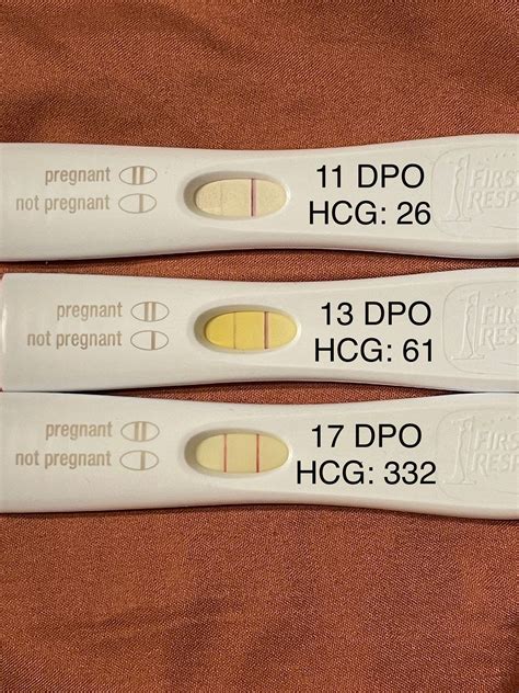 Frer Photos With Hcg Levels Babycenter