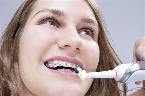 20 Tips For Braces Success Hawley Orthodontics Papillion Ne