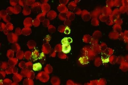 It attacks the vains that line the bones which causes it to become leaky and ticks that are infected spread this. Rickettsia monoclonal antibody
