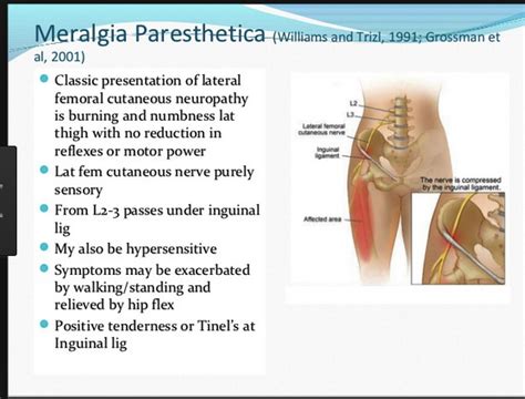 What Is The Best Treatment For Meralgia Paresthetica