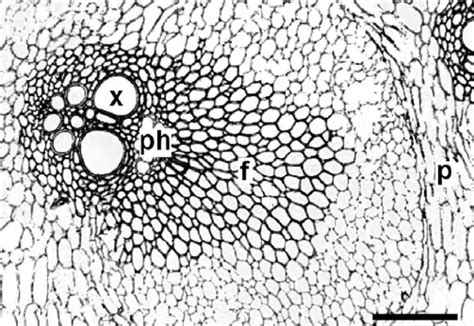 Cross Section Of Vascular Bundle With Fiber Cap In The Stem Cortex Of