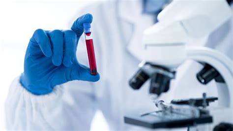Nhs To Pilot Blood Test Detecting 50 Types Of Cancer For One Million