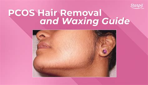 Pcos Hair Removal And Waxing Guide Starpil Wax