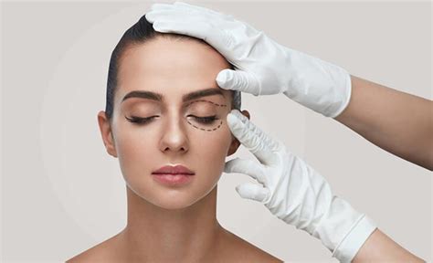 What Are The Steps In Blepharoplasty By Drrajatgupta Jun 2023