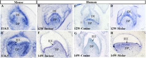 Expression Patterns Of Ptc1 In The Developing Human And Mouse Tooth