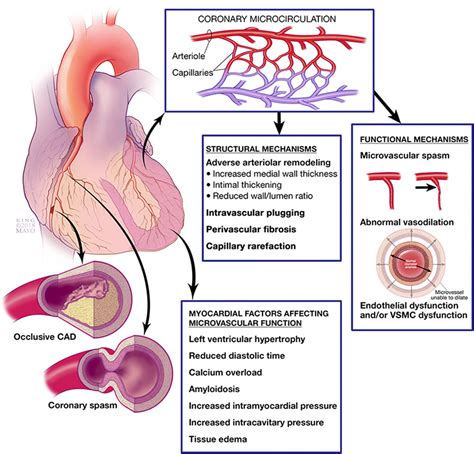 Reappraisal Of Ischemic Heart Disease Circulation