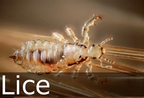Head Lice Photo Pictures The Lice Company