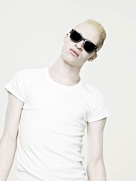 African Albino Stock Photos Pictures And Royalty Free Images Istock
