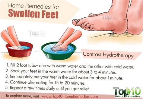 Home Remedies For Swollen Feet Top 10 Home Remedies