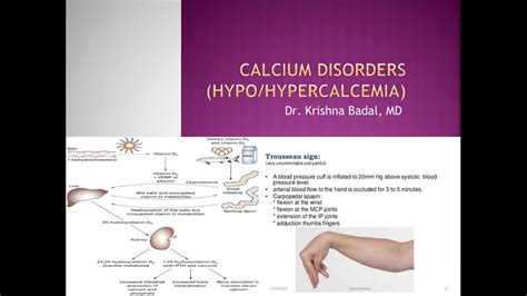 Hypocalcemia And Hypercalcemia In Children Youtube