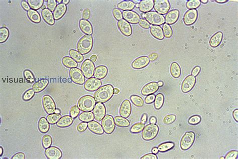 Yeast Saccharomyces Cerevisiae Budding Lm Visuals Unlimited